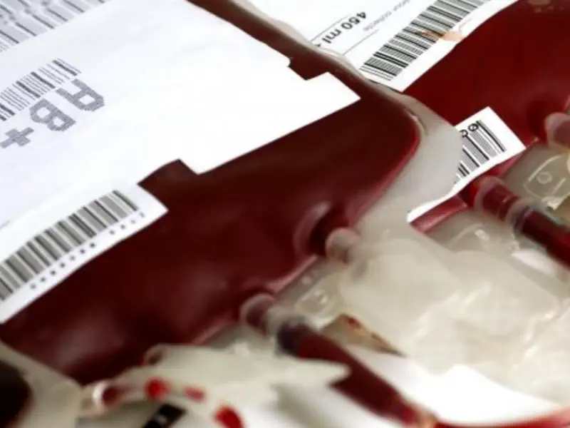 عکس کیسه خون در خط تولید کیسه خون